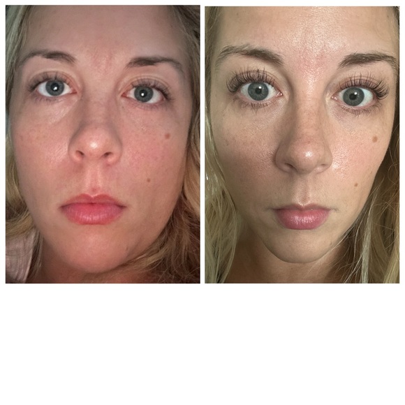 Other - Eyelash Lengthening Serum (with my before & after photos)